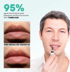 ABERA application on lips using fingertip to show gentle use