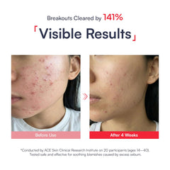 Abso mist droplet on skin texture demonstrating light absorption