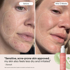 Alpyn Beauty Centella and Ghostberry botanicals highlighting calming benefits