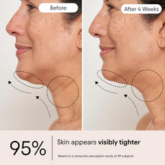 Alpyn Super Sculpt with apple and chokecherry botanicals showing natural support benefit