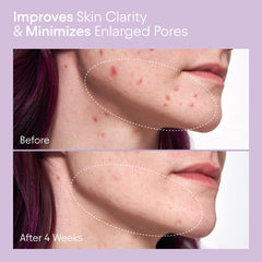 Alpyn liquid texture close-up highlighting lightweight, non-drying formula