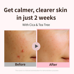 aplin cream texture close-up demonstrating lightweight, quick-absorbing benefit