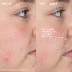 Augustinus Bader cream-to-foam texture demonstrating gentle cleansing