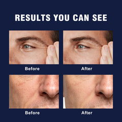 AVITAPURE applied after shaving to soothe skin and reduce redness