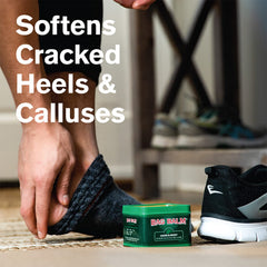Applying Bag Balm to dry hands to soothe and protect skin