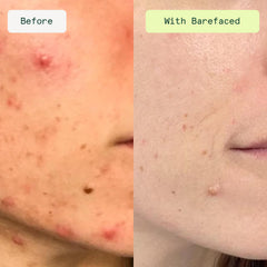 Close-up of a pad texture showing soaked formula and gentle exfoliation