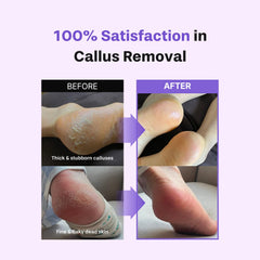 Baren file coarse side close-up removing thick dead skin effectively