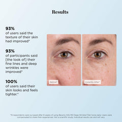Beverly Hills MD applied around eye crow's feet to instantly soften fine lines