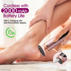Bicboz detachable discs and sanding grit assortment for tailored exfoliation
