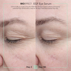 BIOEFFECT serum drop on fingertip showing lightweight texture and quick absorption