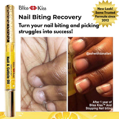 Bliss Kiss pen tip close-up for precise, mess-free cuticle care