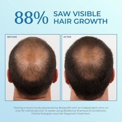 BosleyMD applying spray to thinning scalp showing easy targeted use