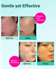 bring green tea tree cica cream open tube hydrating without greasy residue