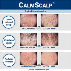 CalmScalp texture close-up demonstrating lightweight serum absorption