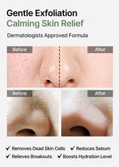 celimax gauze side detail for targeted exfoliation and pore clarity