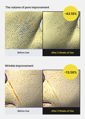 celimax ingredient diagram closeup illustrating retinol and peptide blend benefits