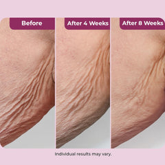 DEKLIDERM applying cream to neck for firmer-looking skin