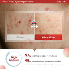 DERMAGENCY Zeroca 86 clear toner drops showing lightweight texture