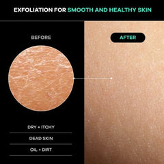 Dermasuri reinforced dual handles detail for controlled pressure and easier reach