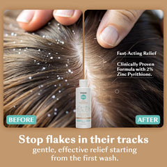 DHS zinc shampoo texture poured onto palm highlighting creamy lather for gentle cleansing