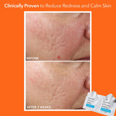 Dr Dennis Gross Step 2 serum closeup highlighting hydration and calming actives