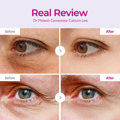 Dr.Melaxin patch applied under-eye demonstrating de-puffing and cooling effect