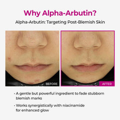 Dr.Melaxin label close-up highlighting alpha-arbutin and niacinamide benefits