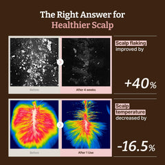 Dr.Reju-All applied to scalp demonstrating targeted, mess-free roll-on benefit