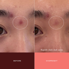 EADEM applying concentrate to cheek spot illustrating targeted coverage benefit
