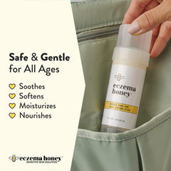 ECZEMA HONEY application on hand demonstrates targeted relief and comfort