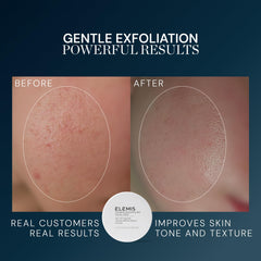 ELEMIS pad solution soaked detail highlighting exfoliating actives and comfort