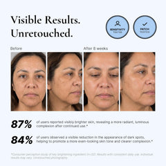 EnaSkin pump dispensing serum into hand for easy application benefit