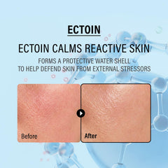 epii ingredient panel close-up showing ectoin squalane niacinamide transparency benefit