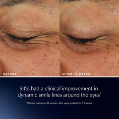 Estée Lauder before and after composite showing visible lift and contouring benefit