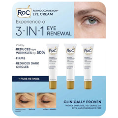 Eye See RoC front packaging showing three 0.6 fl oz tubes, convenient supply