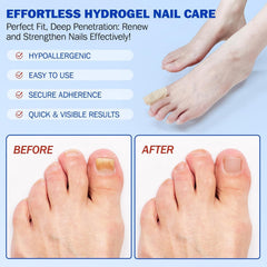 FANSHI patch on toenail overnight for discreet protection