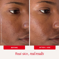 First Aid Beauty pad being applied to face for immediate soothing