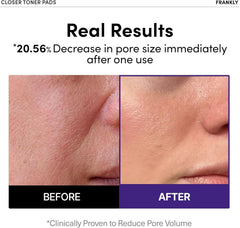 FRANKLY close-up of pad texture highlighting smooth fiber and hydrated serum benefit