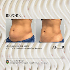 GENTE INC. applying treatment to belly demonstrating cooling sculpting effect