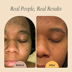 Glo Melanin label close-up showing vitamin C and alpha arbutin ingredients benefit