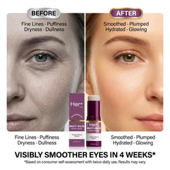 Her+ Axis applying balm to eye area for targeted hydration benefit