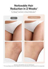 INIA HAUTE Pro close-up of ice-cooling tip highlighting gentle comfort