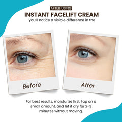 Instantly Ageless application under-eye demo showing targeted use and reduced puffiness