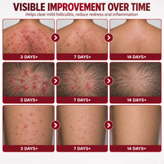 Jorvinl being applied to underarm area for targeted bump care benefit