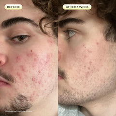 KraveBeauty oil texture drop on hand demonstrating lightweight absorption and non-greasy finish