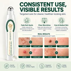 LachVist Picdo texture on skin illustrating smooth, non-greasy finish