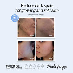 LilyAna Naturals serum dropper releasing clear drop, demonstrating easy application