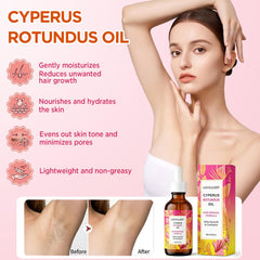 LOVEALERT applied to underarm area calming irritation and moisturizing skin