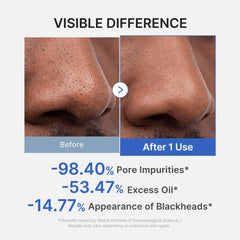medicube spread on cheek demonstrating quick application and cooling