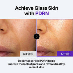 MEDIHEAL applying cream on hand to demonstrate lightweight hydration and spreadability